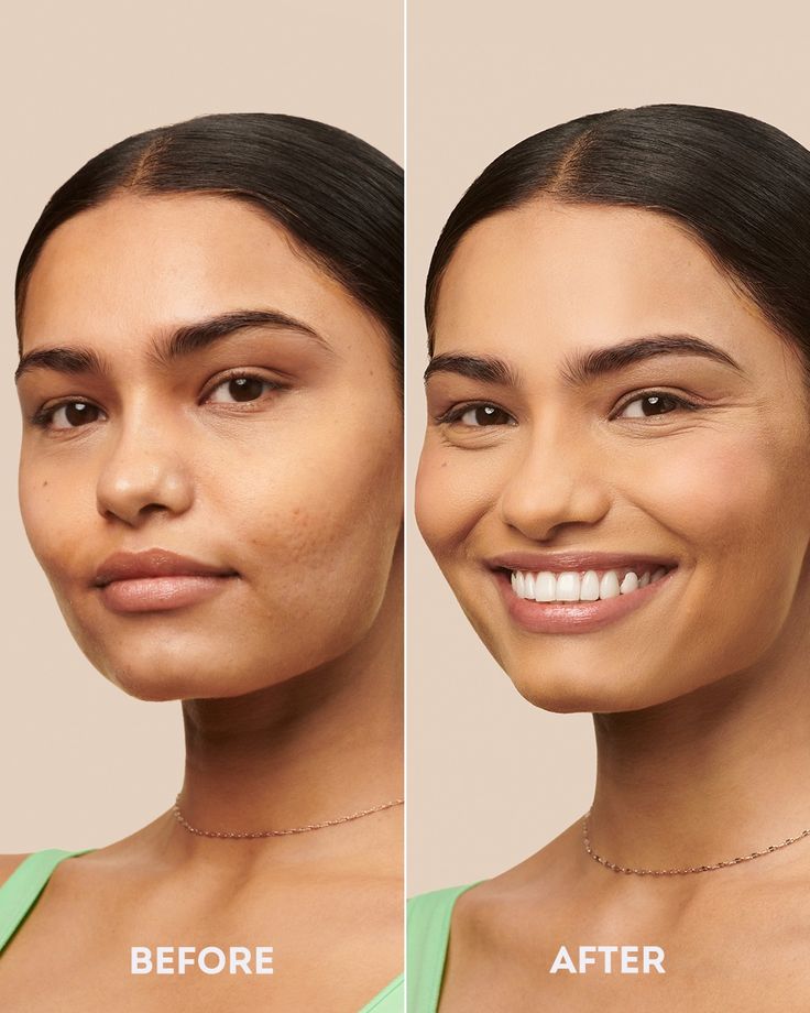 4-in-1 Skincare Wand