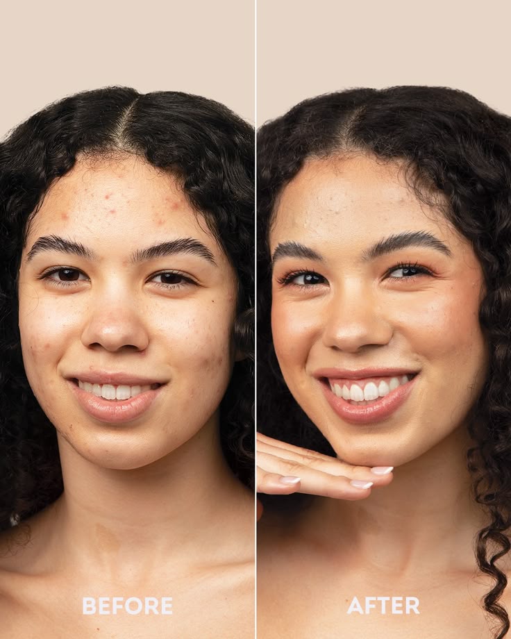 4-in-1 Skincare Wand